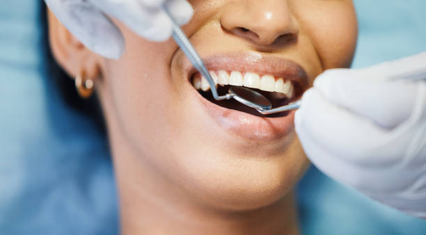 Best Knocked-Out Tooth Emergency  in Dana Point, CA