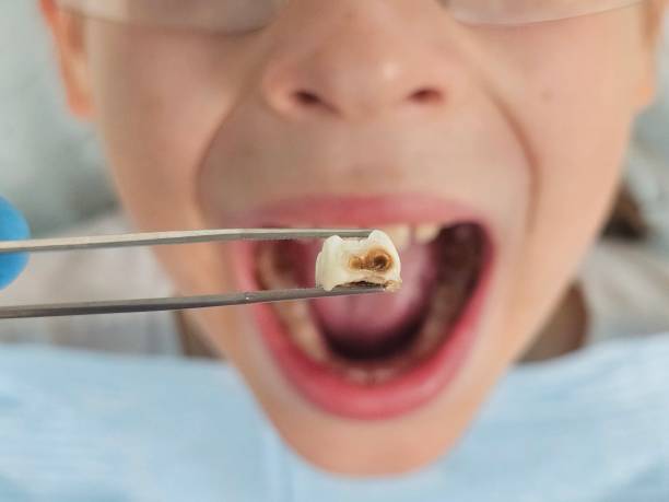 Best Emergency Gum Pain Relief  in Dana Point, CA